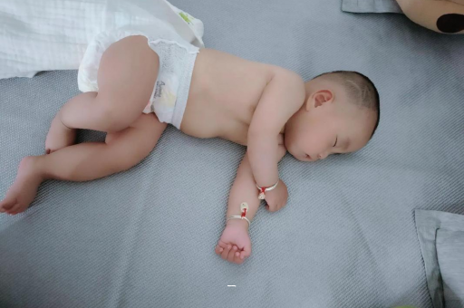 抚顺宝宝脸上有白色斑块